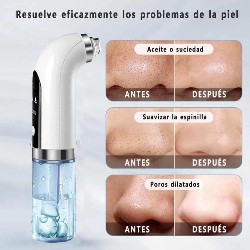 Limpiador de poros - MICRO BUBBLE PRO | Elimina puntos negros y espinillas