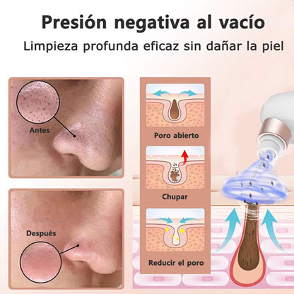 Limpiador de poros - MICRO BUBBLE PRO | Elimina puntos negros y espinillas