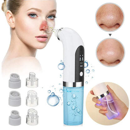 Limpiador de poros - MICRO BUBBLE PRO | Elimina puntos negros y espinillas