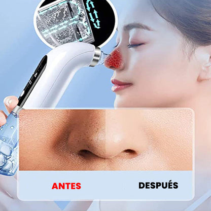 Limpiador de poros - MICRO BUBBLE PRO | Elimina puntos negros y espinillas